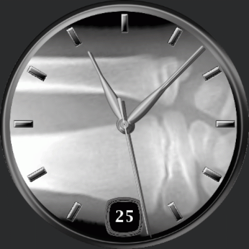 X ray watch