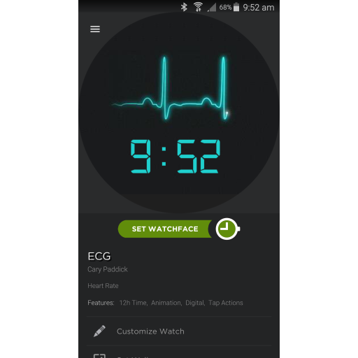 ECG