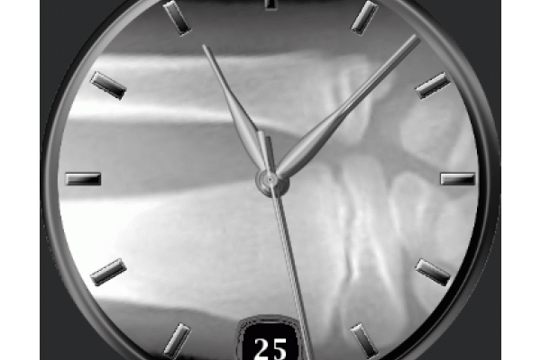 X ray watch