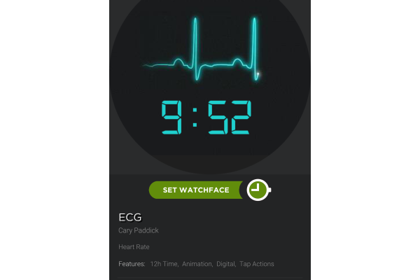 ECG